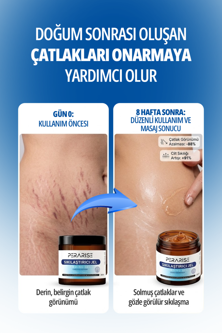 perarise-sıkılaştırıcı3