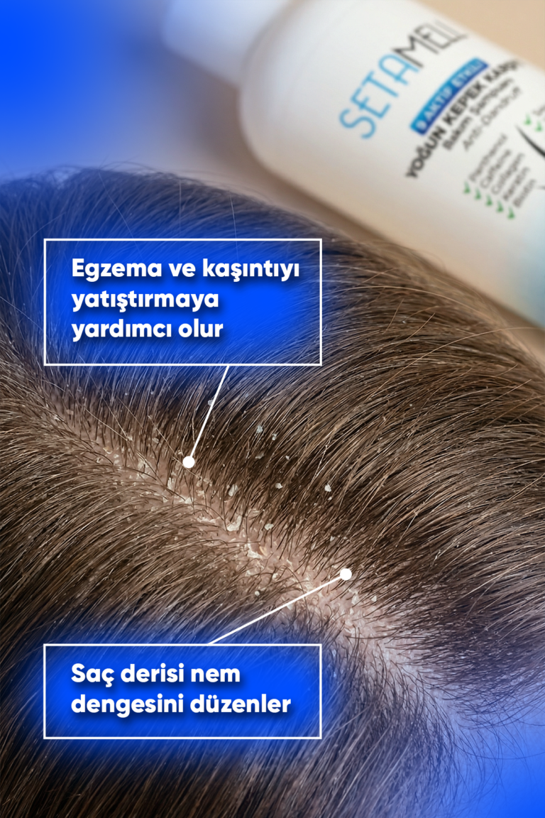 setamell-KEPEK-ŞAMPUAN2