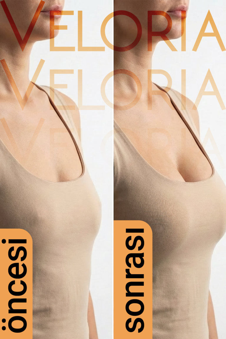 veloria-göğüs4